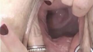 Fucking Huge Eggplant in Pussy - porn video