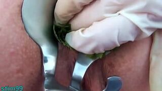 Nettles Ass Fisting Anal Insertion Nettles with Speculum - porn video